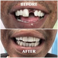 Orthodontic Care